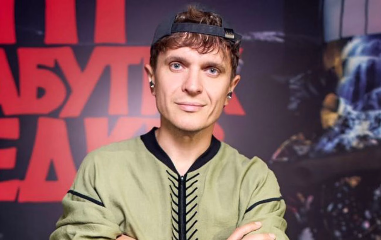 Травма змінила плани: Анатолій Анатолійович продемонстрував загіпсовану ногу